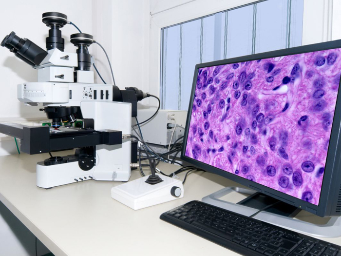 共聚焦显微镜,又称共聚焦激光扫描显微镜(CLSM)